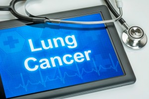 Florida Lung, Asthma and Sleep Specialists treat Lung Cancer. 