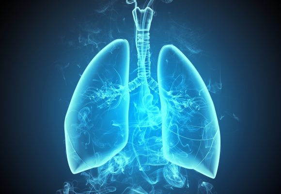Genetics may play a greater role in lung disease than previously considered.