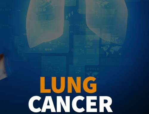 FLASS Lung Cancer Screening Program