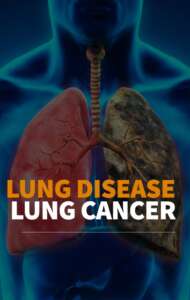 lung cancer symptoms causes and treatment