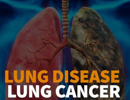 Lung Disease – Lung Cancer