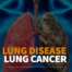 lung cancer symptoms causes and treatment