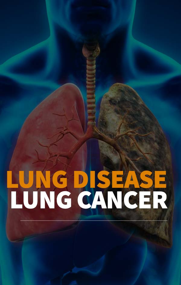 Lung Disease Lung Cancer Florida Lung Asthma And Sleep Specialists