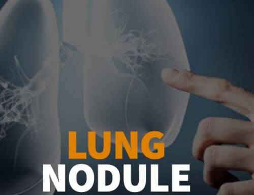 Lung Nodule Management