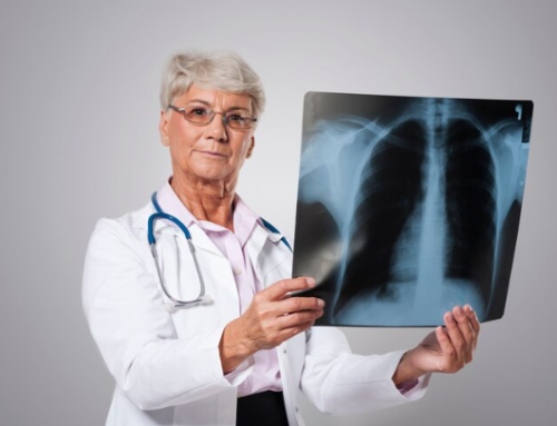 Understanding the Risk Factors for Lung Cancer Recurrence: