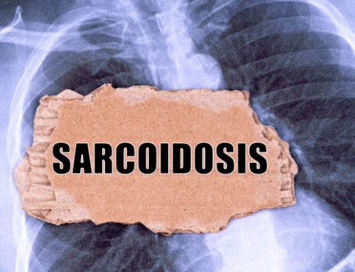 Key Factors That Influence the Success of Sarcoidosis Treatment: