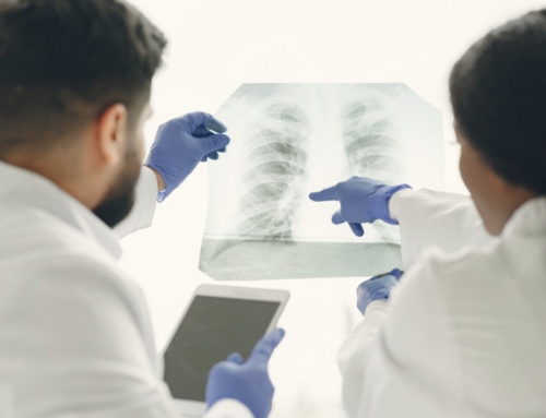 Lung Nodule Treatment Timeline: What Patients Can Expect Step by Step