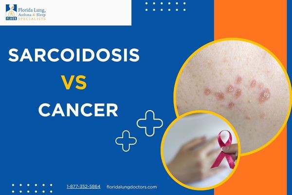 Sarcoidosis VS Cancer