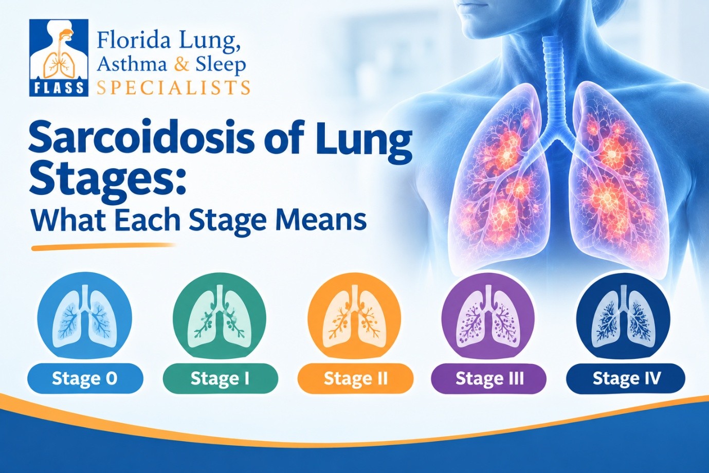 Sarcoidosis of Lung Stages